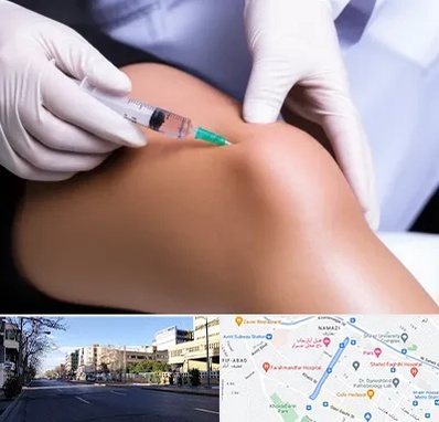 پلاسما درمانی PRP در خیابان ملاصدرا شیراز 