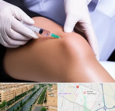 پلاسما درمانی PRP در فاز سه اندیشه