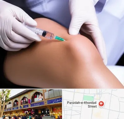 پلاسما درمانی PRP در 15 خرداد