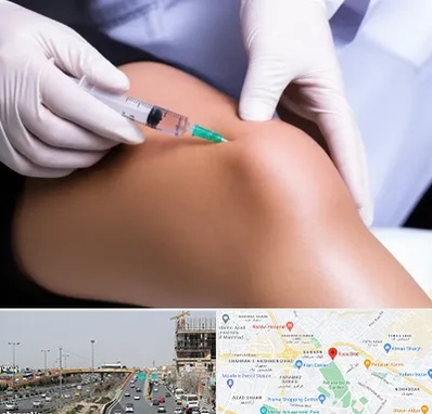 پلاسما درمانی PRP در بلوار توس مشهد 