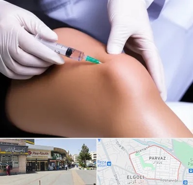 پلاسما درمانی PRP در پرواز تبریز 