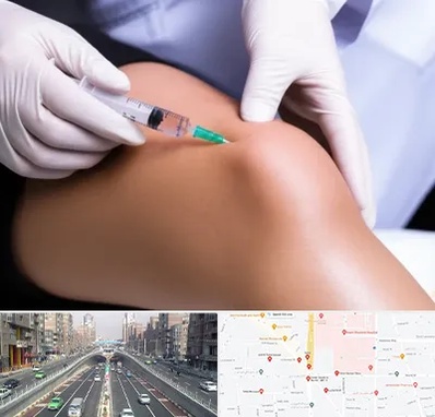 پلاسما درمانی PRP در توحید