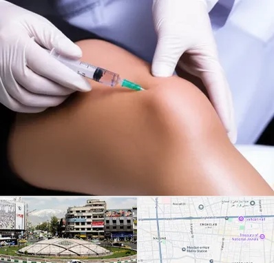 پلاسما درمانی PRP در مرکز تهران 