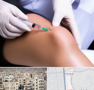 پلاسما درمانی PRP در اسکندری 