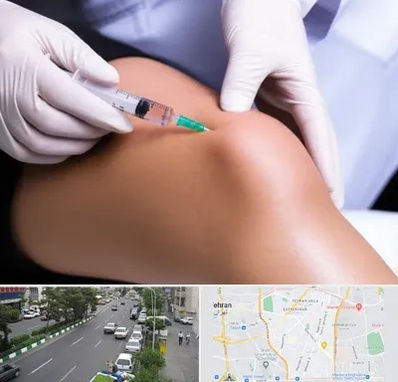 پلاسما درمانی PRP در ستارخان 