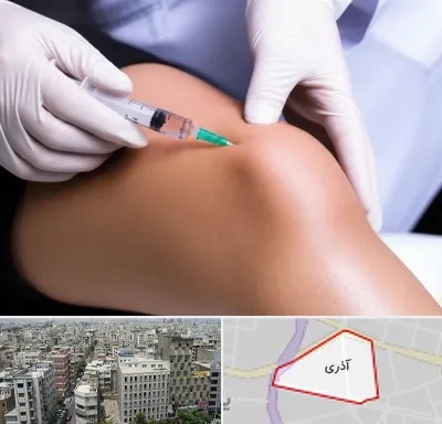 پلاسما درمانی PRP در آذری