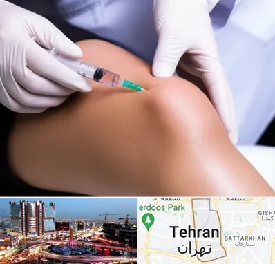 پلاسما درمانی PRP در صادقیه 