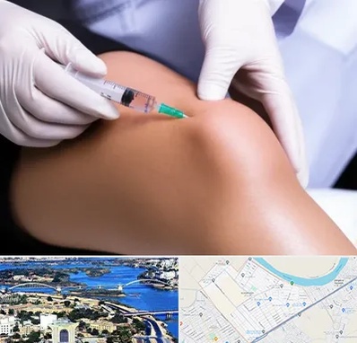 پلاسما درمانی PRP در کوروش اهواز 