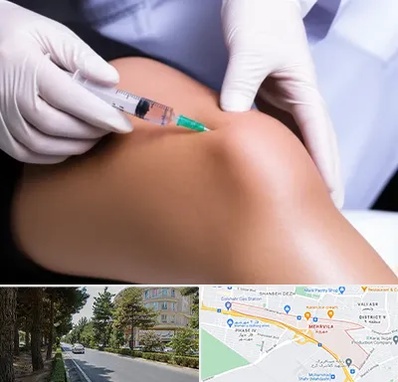 پلاسما درمانی PRP در مهرویلا کرج 