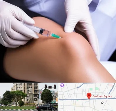 پلاسما درمانی PRP در میدان فردوسی تهران