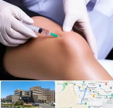 پلاسما درمانی PRP در صیاد شیرازی مشهد 