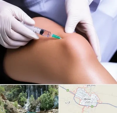 پلاسما درمانی PRP در شیروان