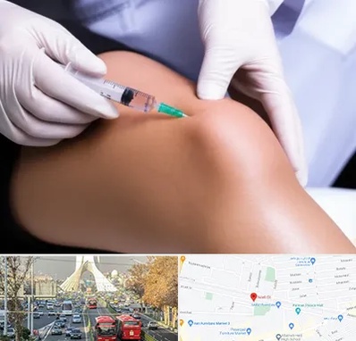 پلاسما درمانی PRP در خیابان آزادی 