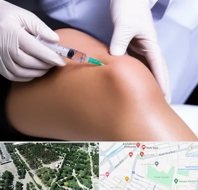 پلاسما درمانی PRP در سالاریه قم 