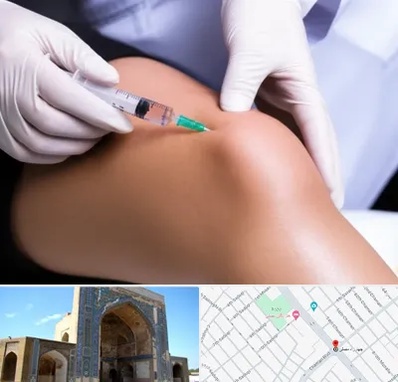 پلاسما درمانی PRP در مصلی مشهد 