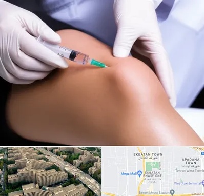 پلاسما درمانی PRP در اکباتان 