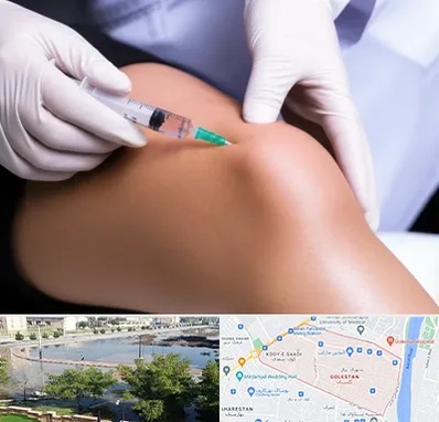 پلاسما درمانی PRP در گلستان اهواز 