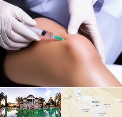 پلاسما درمانی PRP در شیراز