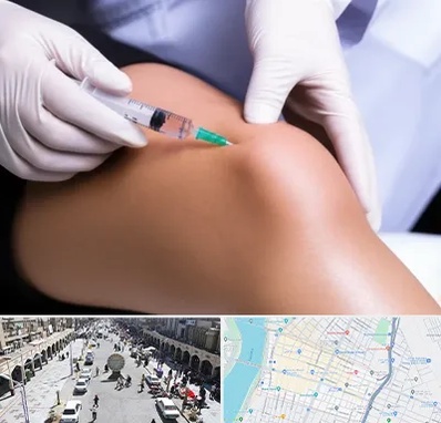 پلاسما درمانی PRP در نادری اهواز 