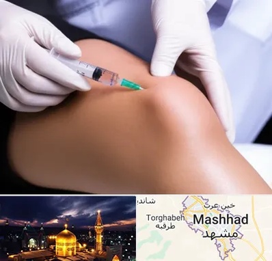 پلاسما درمانی PRP در مشهد