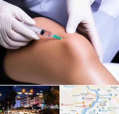 پلاسما درمانی PRP در کیانپارس اهواز 