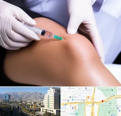 پلاسما درمانی PRP در حقانی 