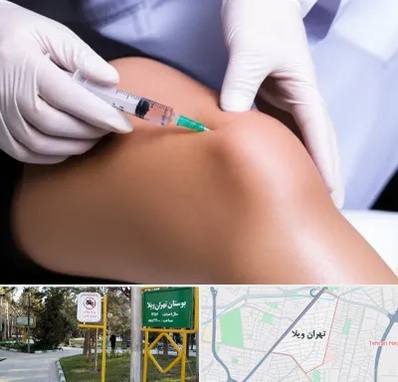 پلاسما درمانی PRP در تهران ویلا