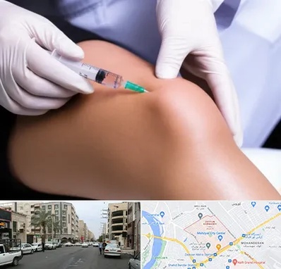 پلاسما درمانی PRP در زیتون کارمندی اهواز 