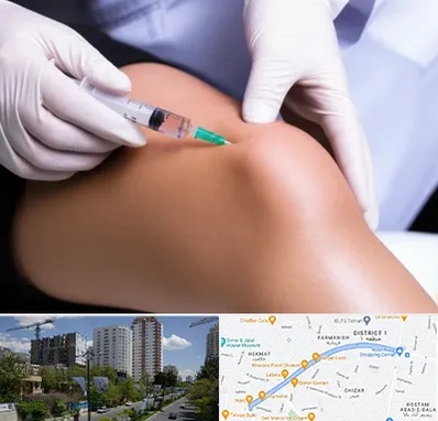 پلاسما درمانی PRP در اندرزگو 