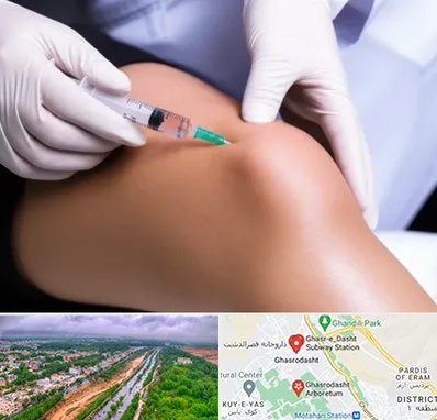 پلاسما درمانی PRP در قصرالدشت شیراز 