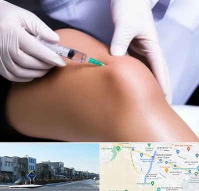 پلاسما درمانی PRP در شریعتی مشهد 