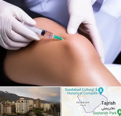 پلاسما درمانی PRP در زعفرانیه 