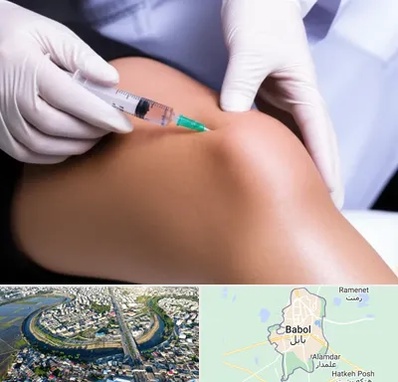 پلاسما درمانی PRP در بابل