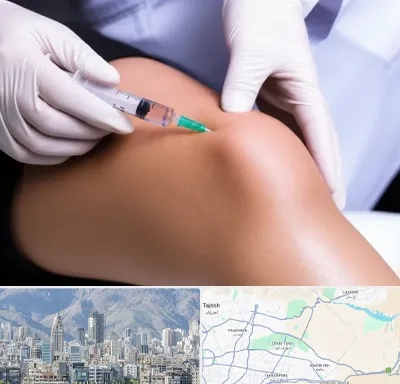 پلاسما درمانی PRP در شمال شرق تهران