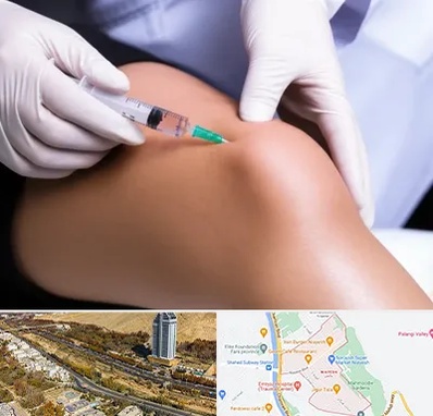 پلاسما درمانی PRP در خیابان نیایش شیراز 