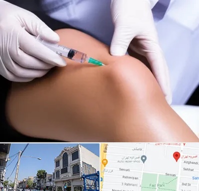 پلاسما درمانی PRP در افسریه 