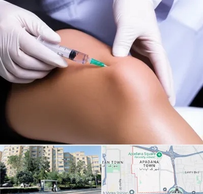 پلاسما درمانی PRP در آپادانا
