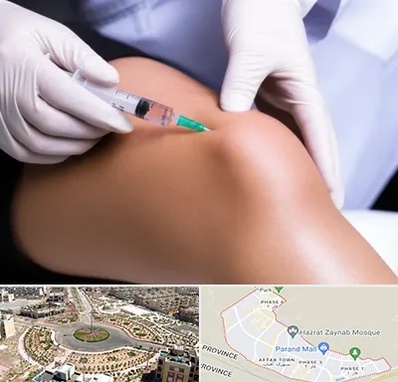 پلاسما درمانی PRP در پرند