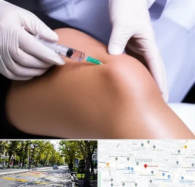 پلاسما درمانی PRP در میرداماد 