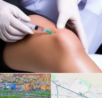 پلاسما درمانی PRP در رشدیه تبریز 