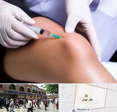 پلاسما درمانی PRP در بازار تهران
