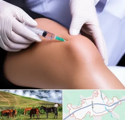 پلاسما درمانی PRP در تالش