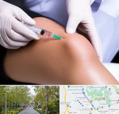 پلاسما درمانی PRP در قدوسی غربی شیراز 