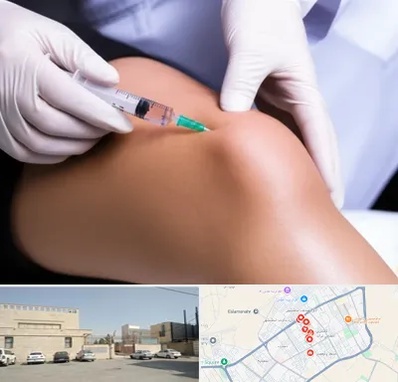 پلاسما درمانی PRP در نواب اسلامشهر 