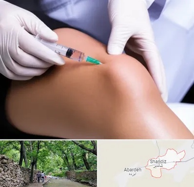 پلاسما درمانی PRP در شاندیز مشهد 