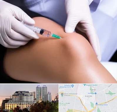 پلاسما درمانی PRP در فرشته 