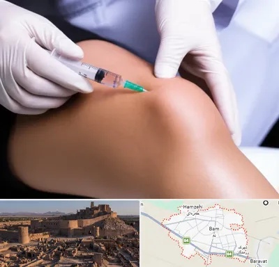 پلاسما درمانی PRP در بم