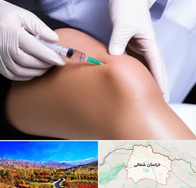 پلاسما درمانی PRP در خراسان شمالی