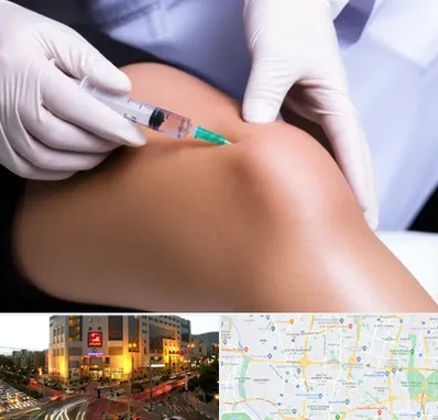 پلاسما درمانی PRP در جنت آباد تهران 