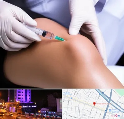 پلاسما درمانی PRP در آبرسان تبریز 